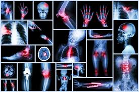 Orthopedics & Trauma